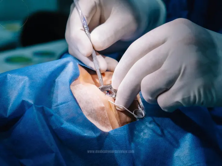 Common Surgical Errors: How They Lead to Medical Malpractice