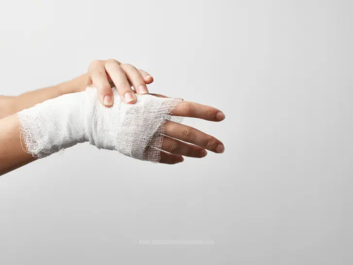 Fracture and broken bone medical record review for personal injury claims to support attorneys’ case evaluation